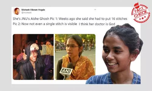 क्या आइशी घोष के सर पर टाँके नकली थे? फ़र्ज़ी दावा हो रहा है वायरल