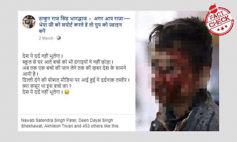 बम धमाके में घायल सीरियन बच्चे की पुरानी तस्वीर दिल्ली दंगो से जोड़ कर वायरल हुई बम धमाके में घायल सीरियन बच्चे की पुरानी तस्वीर दिल्ली दंगो से जोड़ कर वायरल हुई