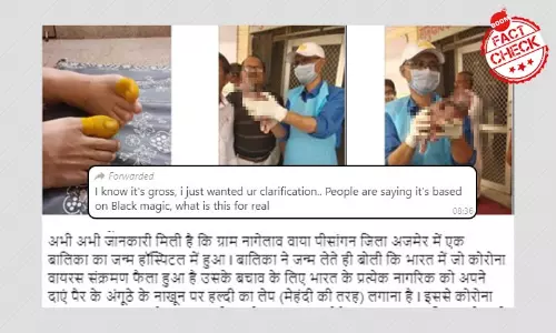 बर्थ-डिफ़ेक्ट के साथ पैदा हुए बच्चे की तस्वीर कोरोनावायरस से जोड़ कर वायरल