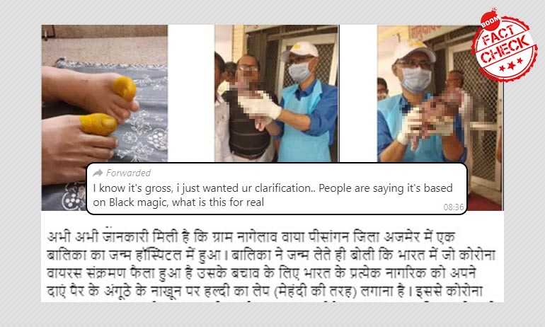 बर्थ-डिफ़ेक्ट के साथ पैदा हुए बच्चे की तस्वीर कोरोनावायरस से जोड़ कर वायरल बर्थ-डिफ़ेक्ट के साथ पैदा हुए बच्चे की तस्वीर कोरोनावायरस से जोड़ कर वायरल