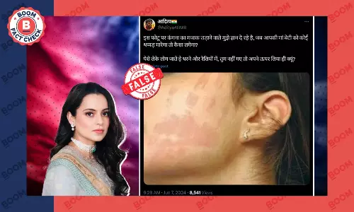 फैक्ट चेक: गाल पर थप्पड़ के निशान वाली यह तस्वीर कंगना रनौत की नहीं है फैक्ट चेक: गाल पर थप्पड़ के निशान वाली यह तस्वीर कंगना रनौत की नहीं है
